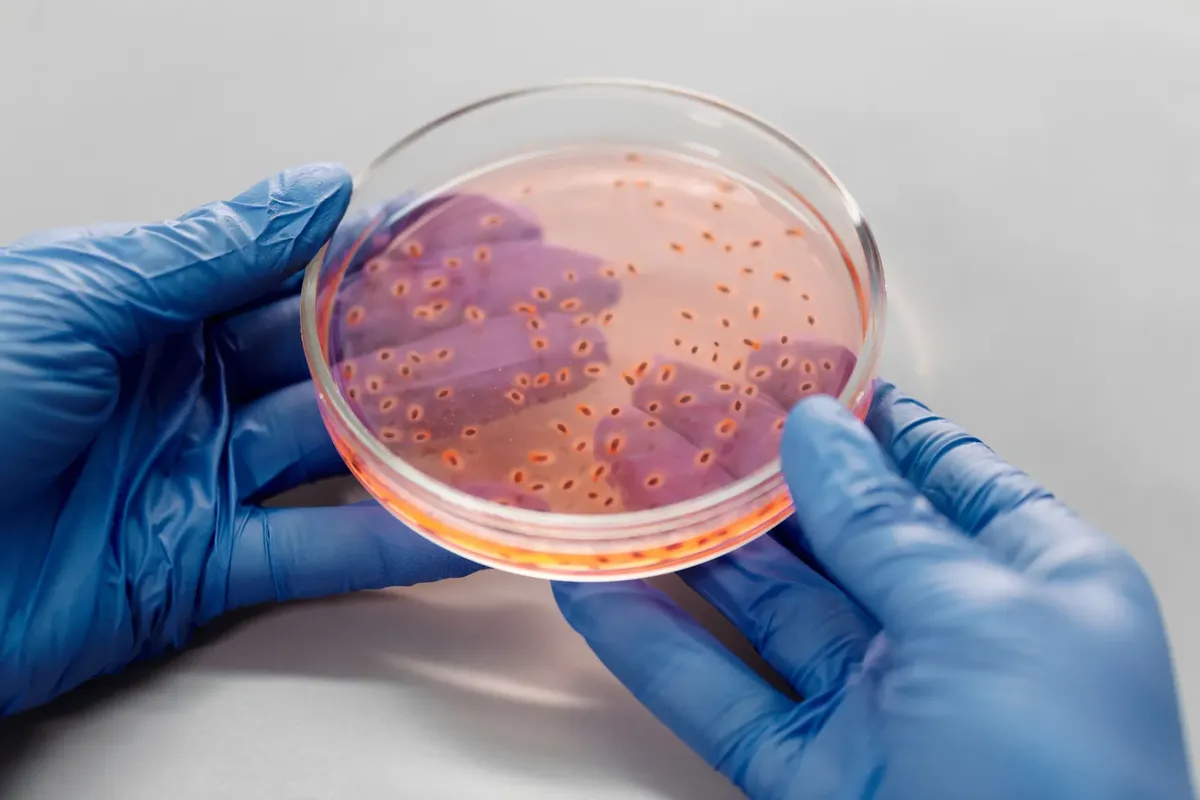 実験室での様子で、手袋を着けた手が培菌皿を握っている。